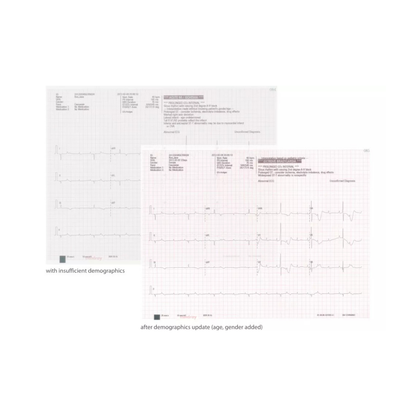 Papel de Impresión para Electrocardiografo R12, 210mmX295mm, 150 hojas Mindray